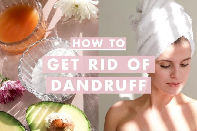 Best Home Remedies for Dandruff